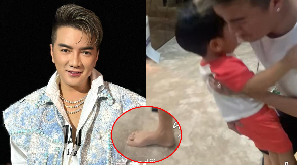 Đàm Vĩnh Hưng lộ ảnh cận cảnh bàn chân bị t/ai n/ạn ở nhà tỷ phú Mỹ, CDM sửng sốt dụi mắt 7 lần: Vẫn còn nguyên 5 ngón cơ mà?