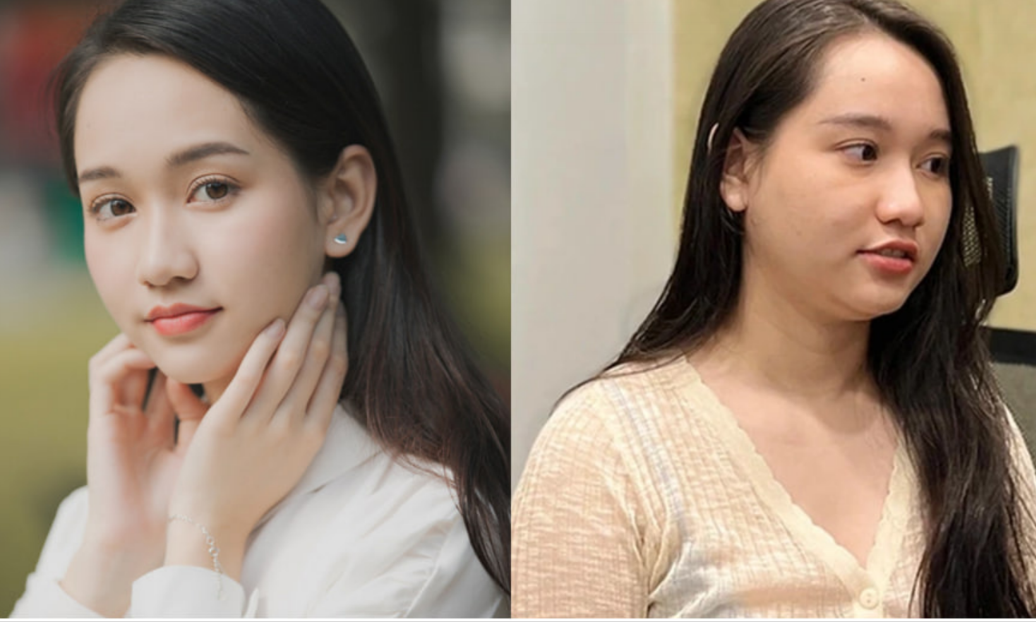 Nữ chính Mắt Biếc từng có giao diện như nàng thơ trong tranh, nay xuất hiện với diện mạo không thể nhận ra: ‘Bệnh tật dày vò, thấy mà thương’