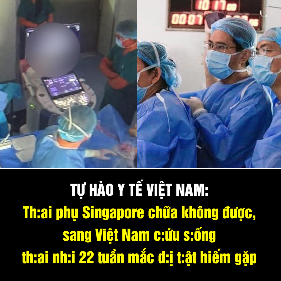 TỰ HÀO Y TẾ VIỆT NAM: Th:ai phụ Singapore chữa không được, sang Việt Nam c:ứu s:ống th:ai nh:i 22 tuần mắc d:ị t:ật hiếm gặp
