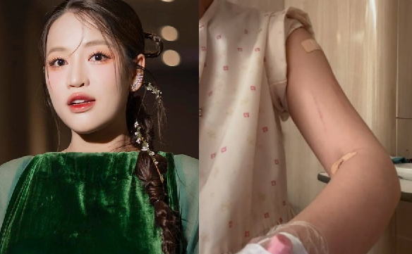 Puka lộ diện với thân hình gầy rộc, chi chít băng gạc sau sinh: Đồng nghiệp xót xa, fan lo lắng tột độ