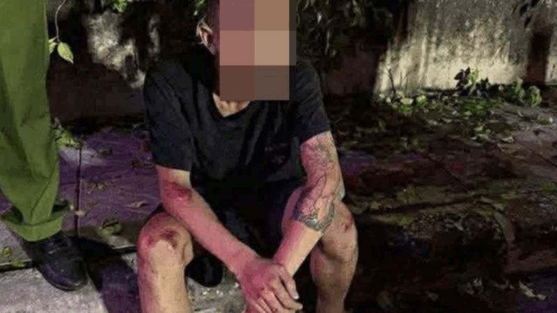 Cập nhật tình hình hiện tại của chiến sĩ cảnh sát cơ động bị 2 thanh niên ‘thông chốt’ đường cấm tô:ng tr:úng