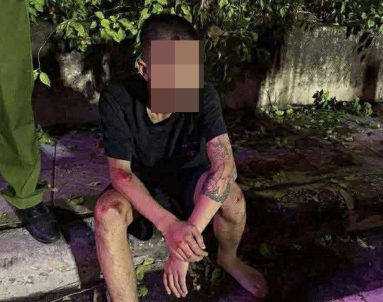 Cập nhật tình hình hiện tại của chiến sĩ cảnh sát cơ động bị 2 thanh niên ‘thông chốt’ đường cấm tô:ng tr:úng