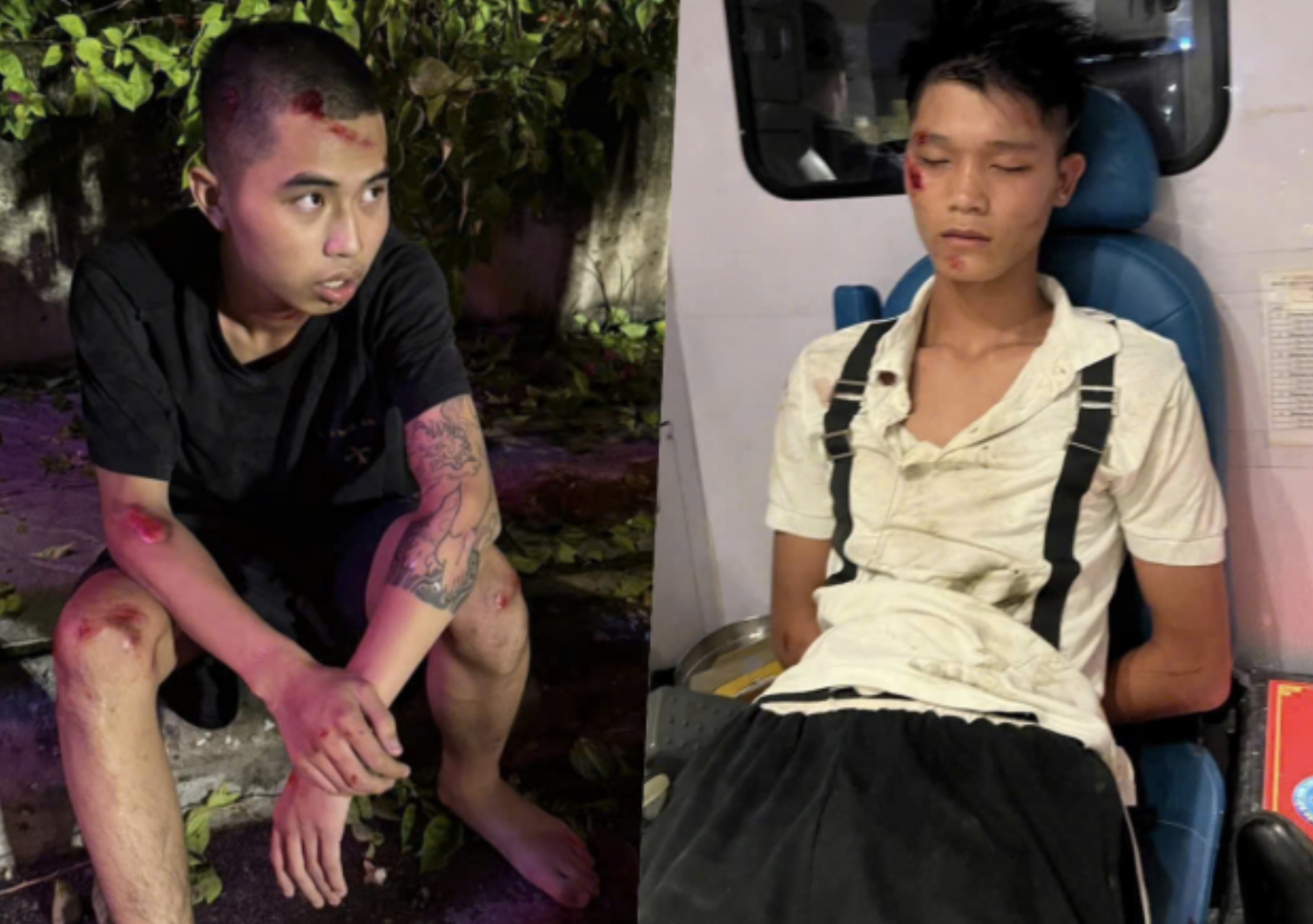 Bắt giữ ‘qu:ái xế’ thông chốt, t:ô:ng CSCĐ ch::ấn thư:ơng s:ọ n:ã:o, đối diện chế tài xử lý nào?