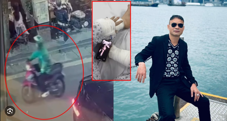 Đáng sợ thật: Người phụ nữ bị xe ôm công nghệ tạt axit khi đang ngồi cafe, tổn thương 35%, truy lùng kẻ chủ mưu?