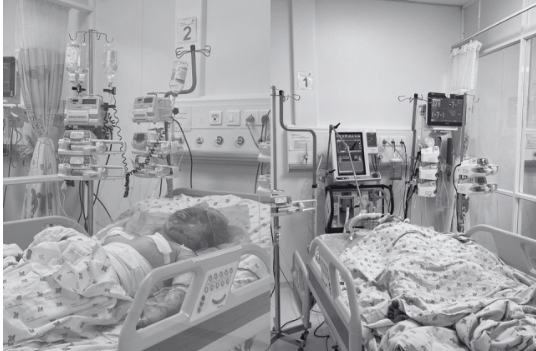 Xót xa tình hình của hai chị em bị cha ruột tư:ới xă:ng ph:óng h:ỏa khi đang ngủ, 1 em ti:ên lượ:ng xấu