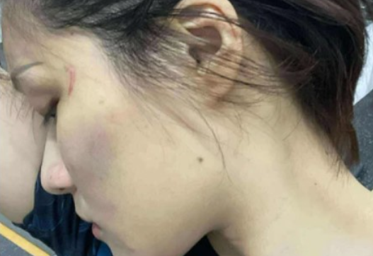 Đã rõ lý do xô xát của cô gái MMA tung liên hoàn cư:ớc với thanh niên xăm trổ ở hầm gửi xe