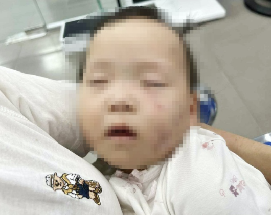 Vụ ở Bắc Ninh, cô giáo mầm non b::ạ:o h:à:nh bé 14 tháng tuổi, đối diện án phạt nghiêm khắc nào?